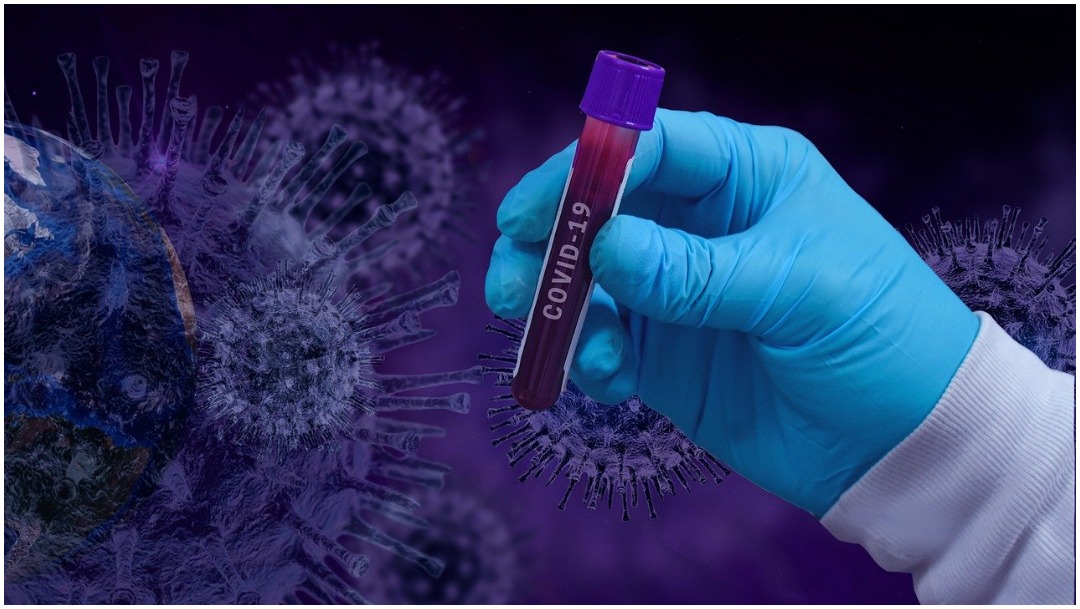 Imagen: Aseguran que el coronavirus no resiste altas temperaturas, 18 de abril de 2020 (Pixabay)