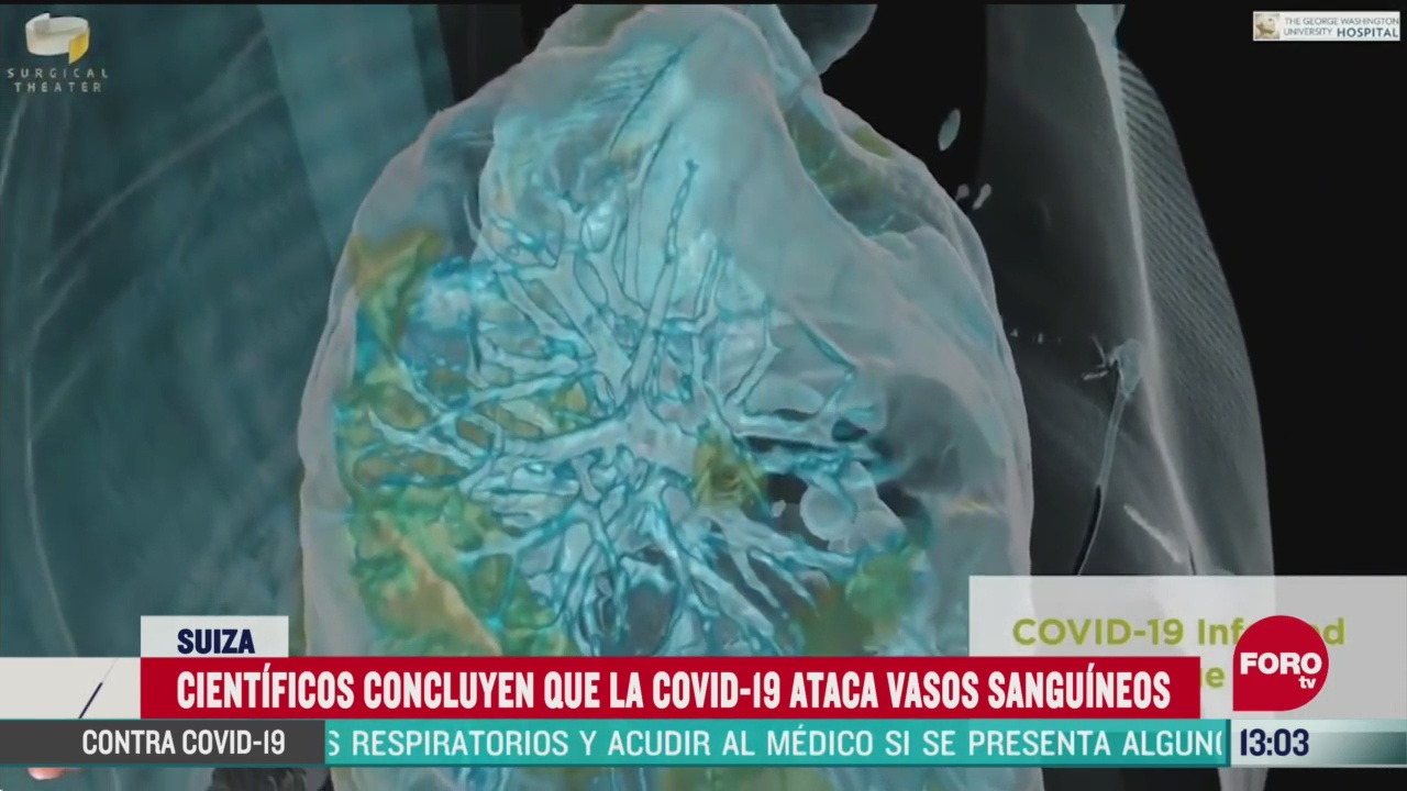 FOTO: coronavirus ataca vasos sanguineos segun especialistas