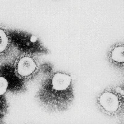 Síndrome inflamatorio afecta a niños con coronavirus en Europa