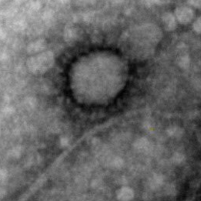 Revelan primera foto del nuevo coronavirus que circula en Argentina