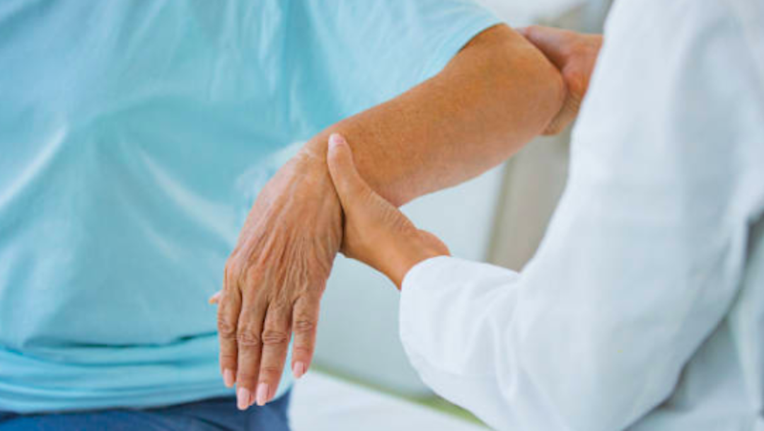 ¿Qué es la artritis reumatoide y cuáles son sus síntomas?
