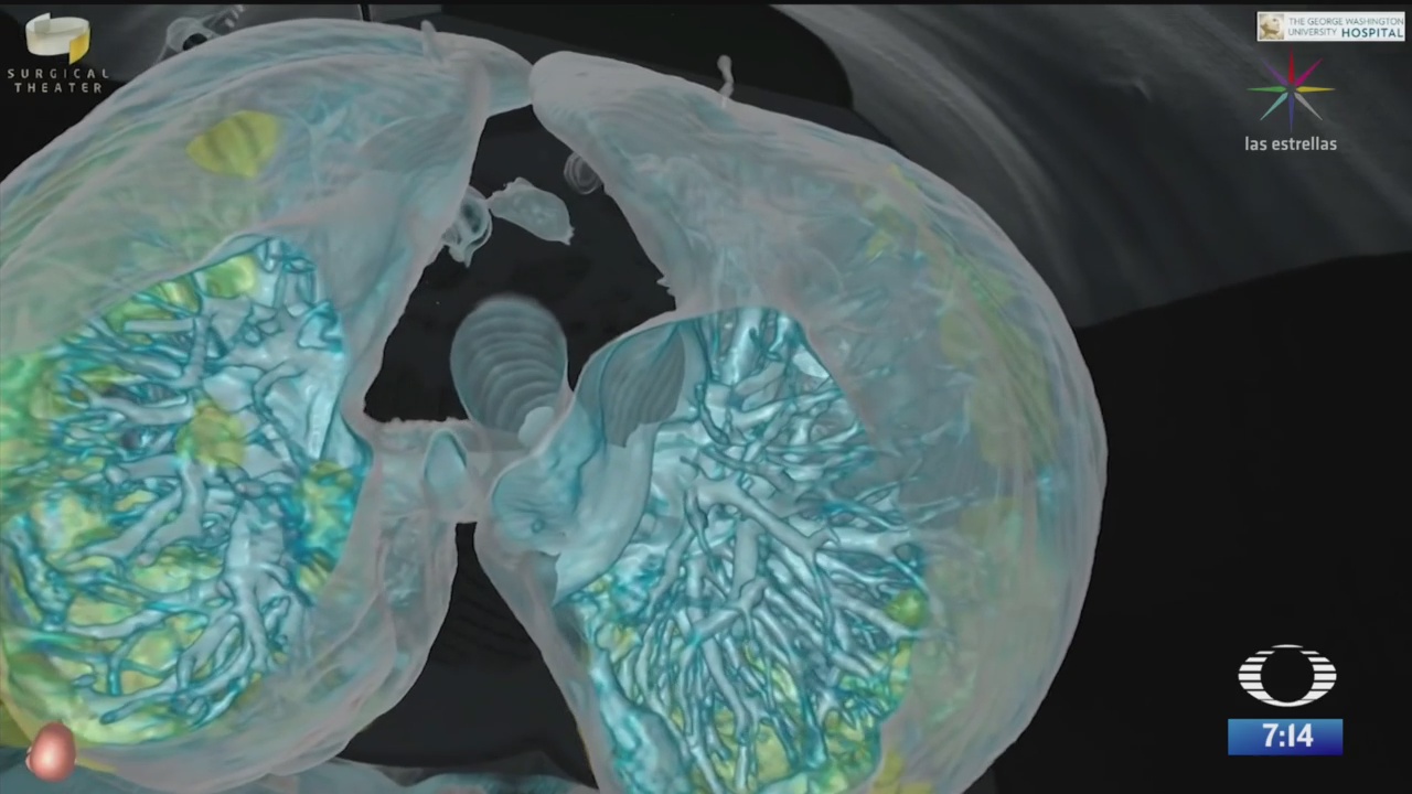 modelo en realidad virtual muestra dano en pulmones por coronavirus