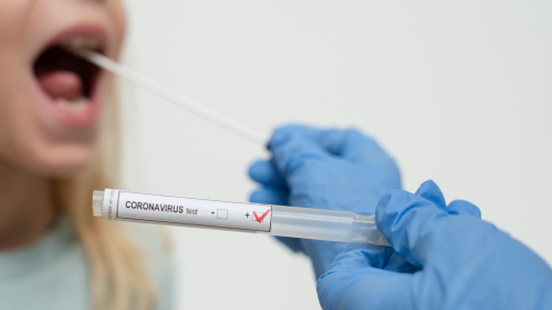 Pruebas para coronavirus. Getty Images/Archivo