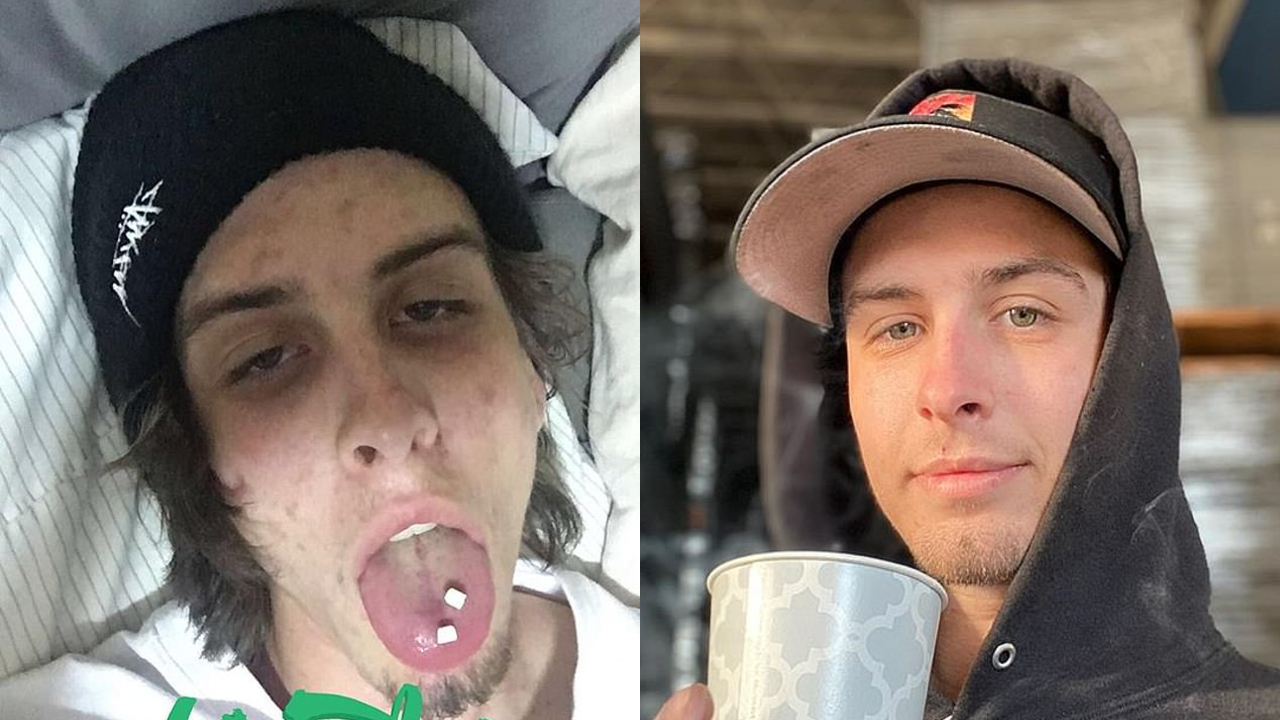 Fotos comparando a un adicto después de dos años de estar sobrio.