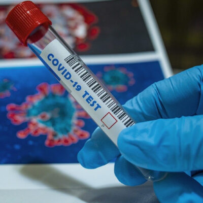 Cómo saber si ya tuviste coronavirus o si tienes anticuerpos