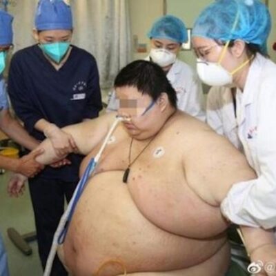 Hombre aumenta 100 kilos tras pasar 5 meses en casa por la cuarentena