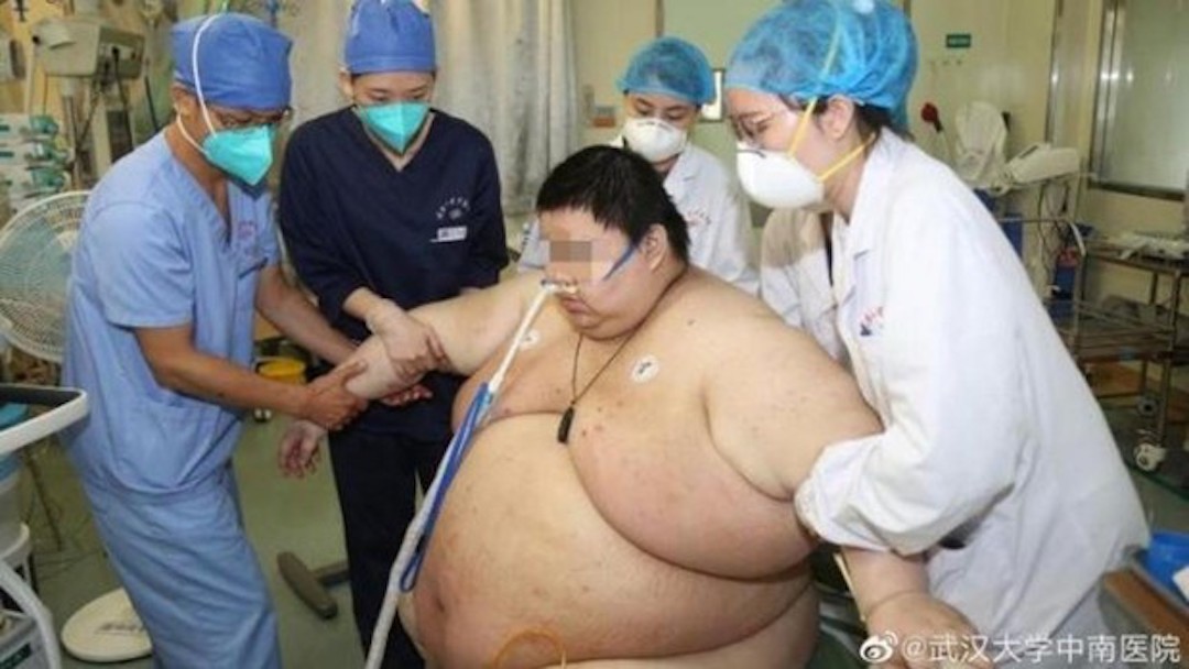 Hombre Sobrepeso Levantado Personal Médico Hospital Foto