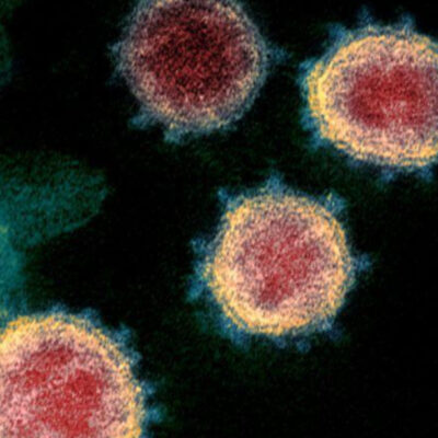 Mutación del coronavirus aumenta las posibilidades de infección, revela estudio