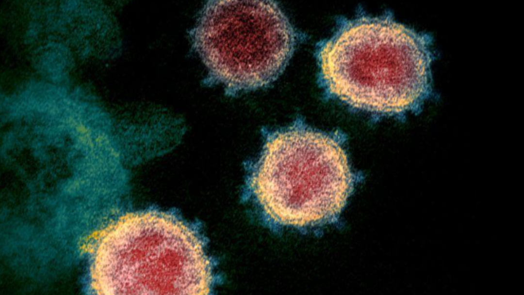FOTO: Mutación del coronavirus aumenta las posibilidades de infección, revela estudio, el 15 de junio de 2020
