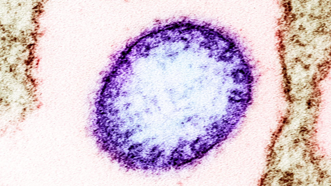 Imagen del virus de Nipah