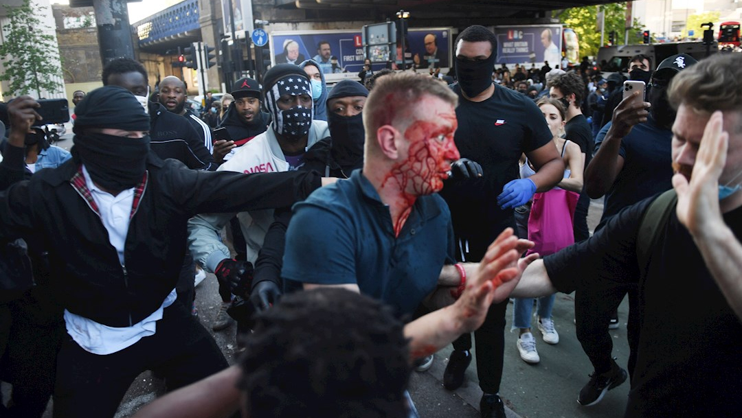 Fotografía que muestra a una persona herida tras los enfrentamientos durante las protestas contra el racismo en Reino Unido. (EFE)