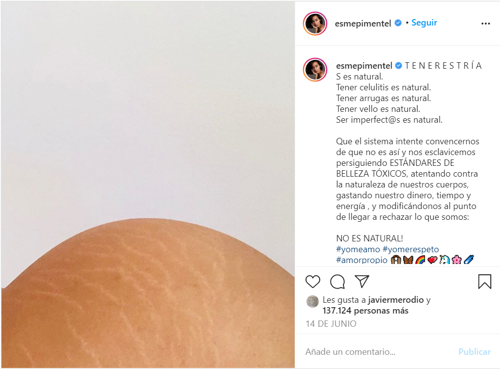 esmeralda pimentel muestra estrias en instagram con una publicacion