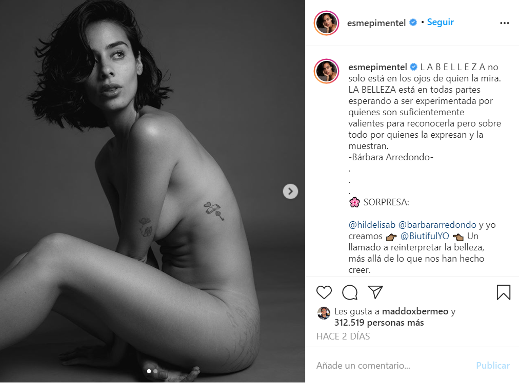esmeralda pimentel muestra estrias en instagram con una publicación