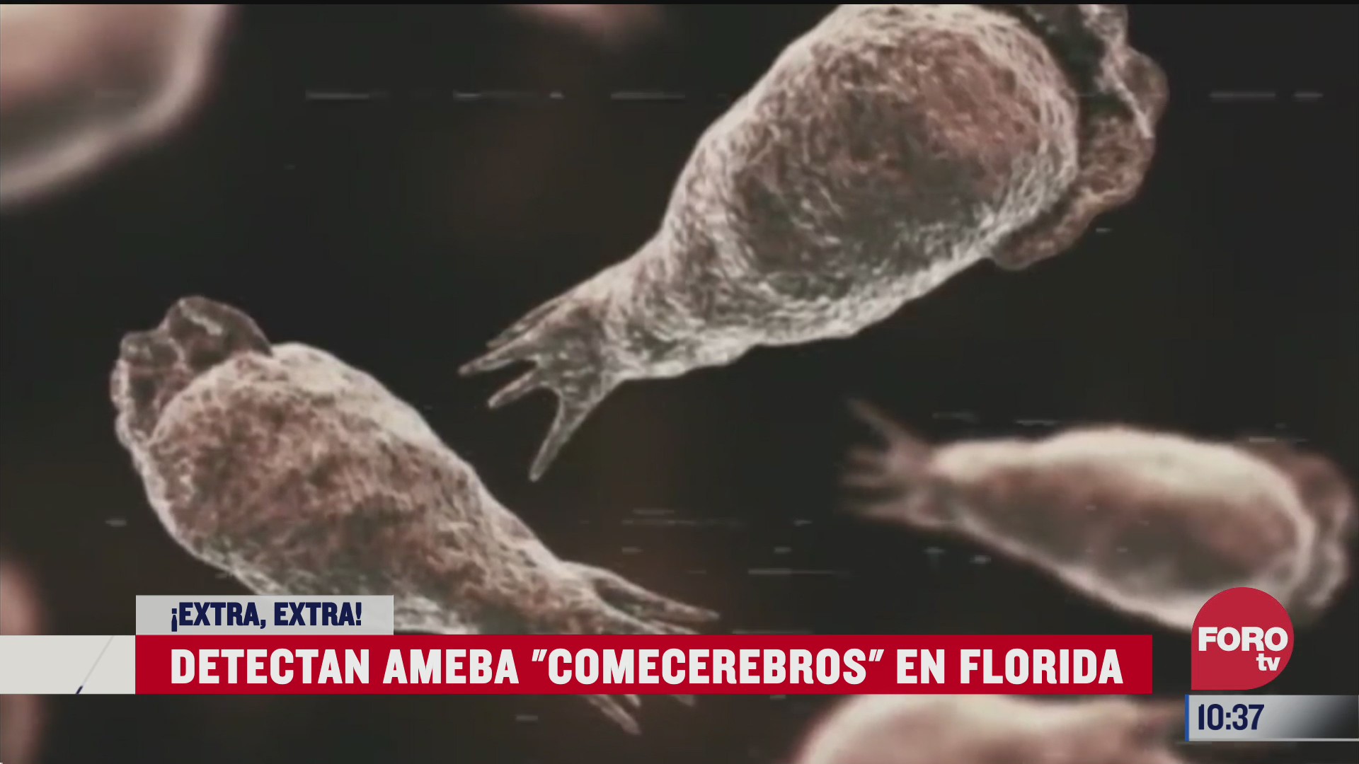 extra extra detectan ameba comecerebros en florida