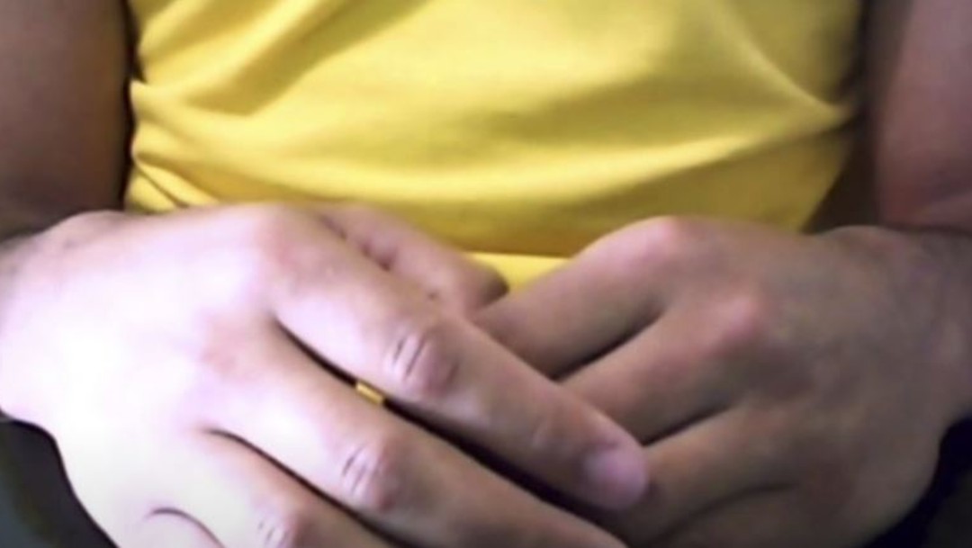 Manos de un hombre brasileño infectado con VIH