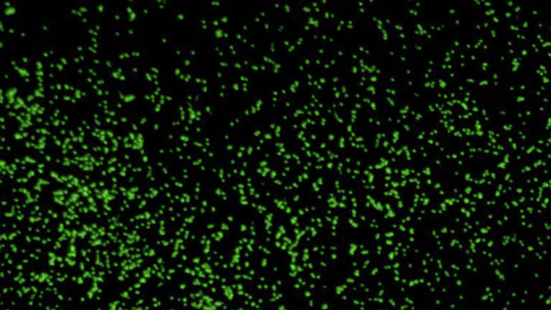 Una imagen agrandada de los microbios hallados a 5 mil 700 metros de profundidad por la nave de investigación JOIDES Resolution