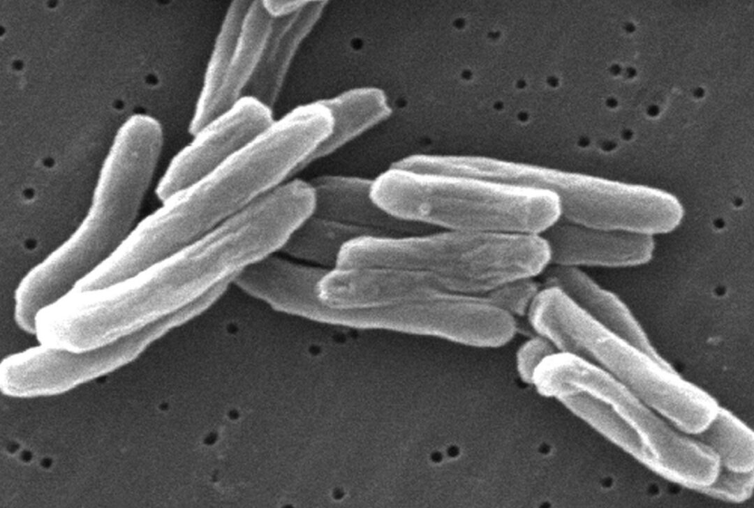 Graban muerte de célula infectada de tuberculosis