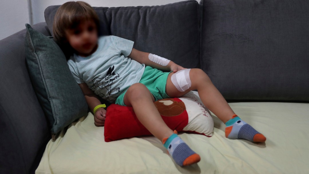 Los niños en Beirut sufren trauma tras la potente explosión