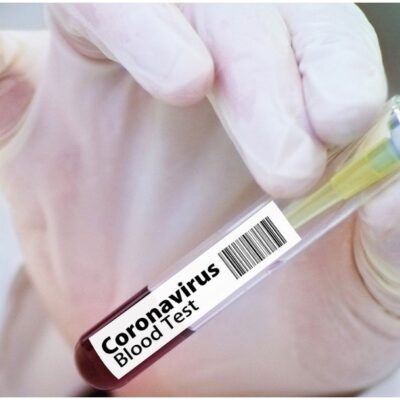 Rusia venderá su vacuna contra COVID-19 con el nombre de Sputnik V