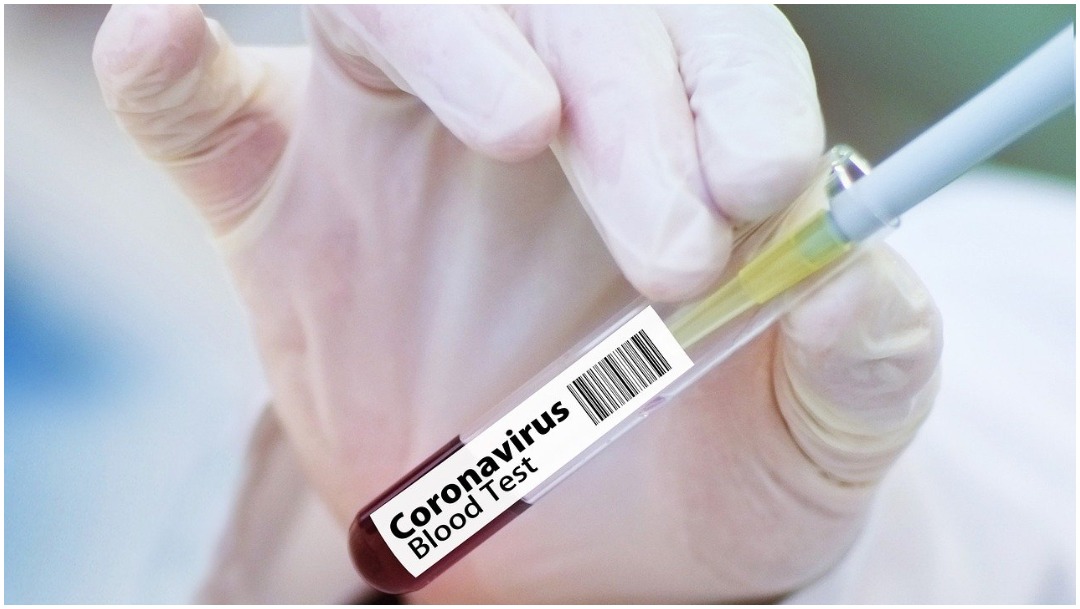 Prueba de vacuna contra el coronavirus COVID-19