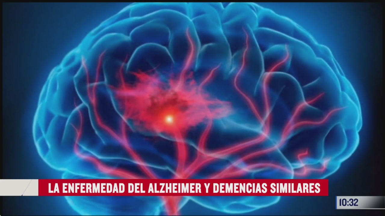 la enfermedad del alzheimer y demencias similares