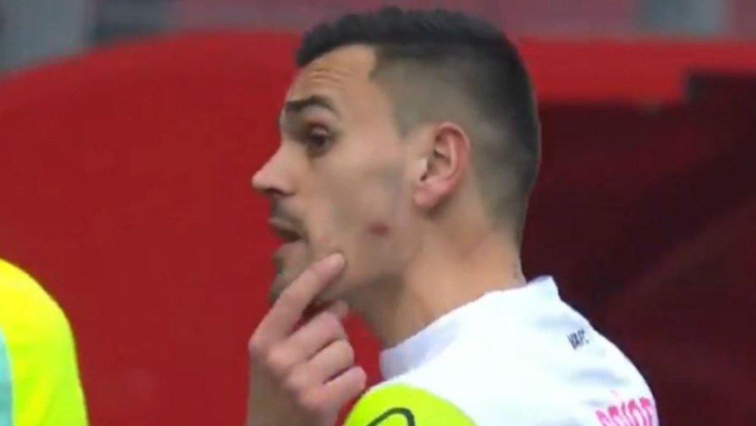 El futbolista del Valenciennes, Jerôme Prior, muestra la lesión provocada tras ser mordido por un jugador rival