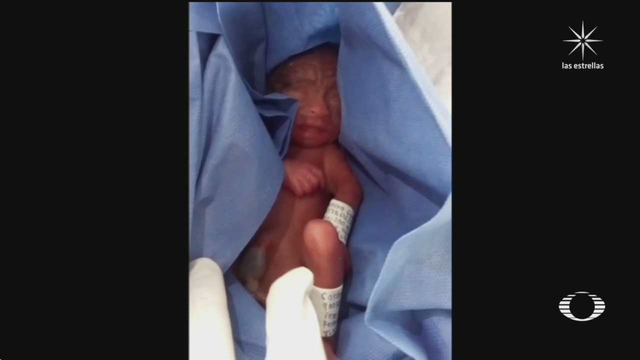 hospital del imss en puebla declara muerto a bebe prematuro que seguia vivo