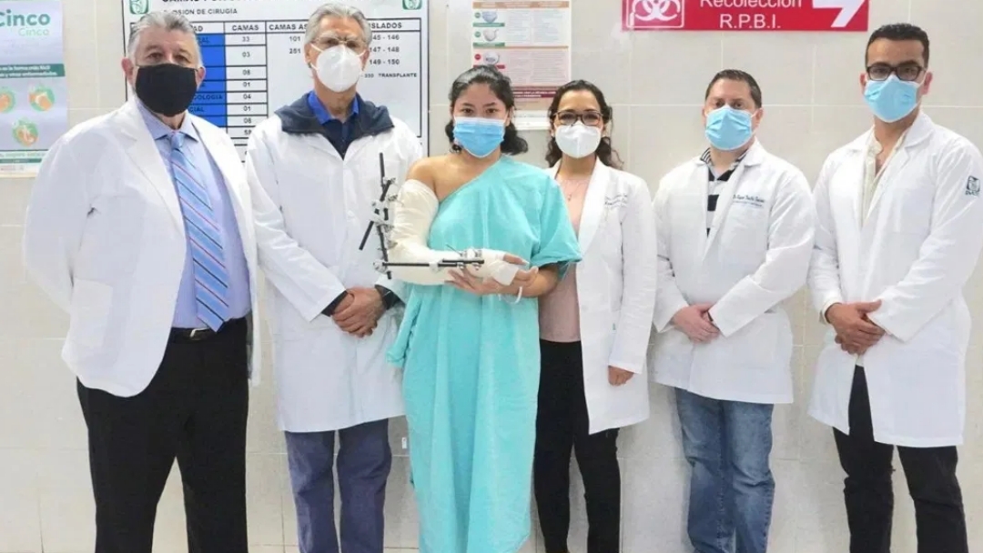 Médicos del IMSS reimplantan brazo de mujer de 20 años en Guanajuato