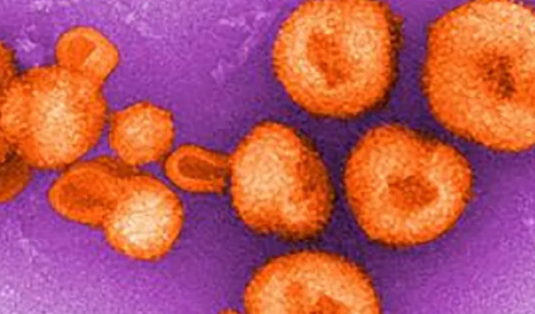 Chapare: el virus parecido al ébola surgido en Bolivia