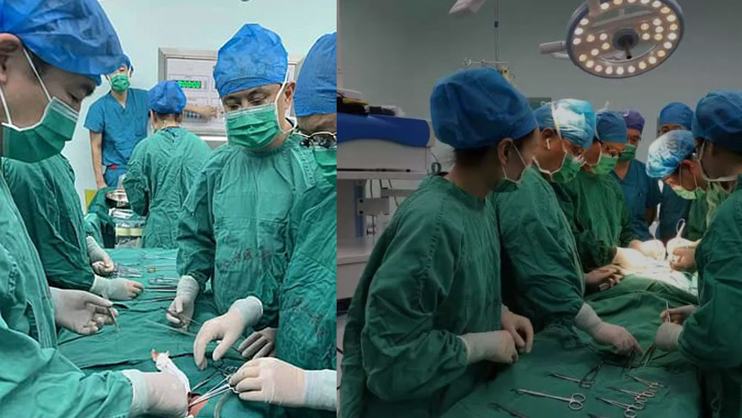 En China, operaron a unas gemelas que estaban unidas por el estómago y fueron sometidas a una cirugía a pesar de tener un día