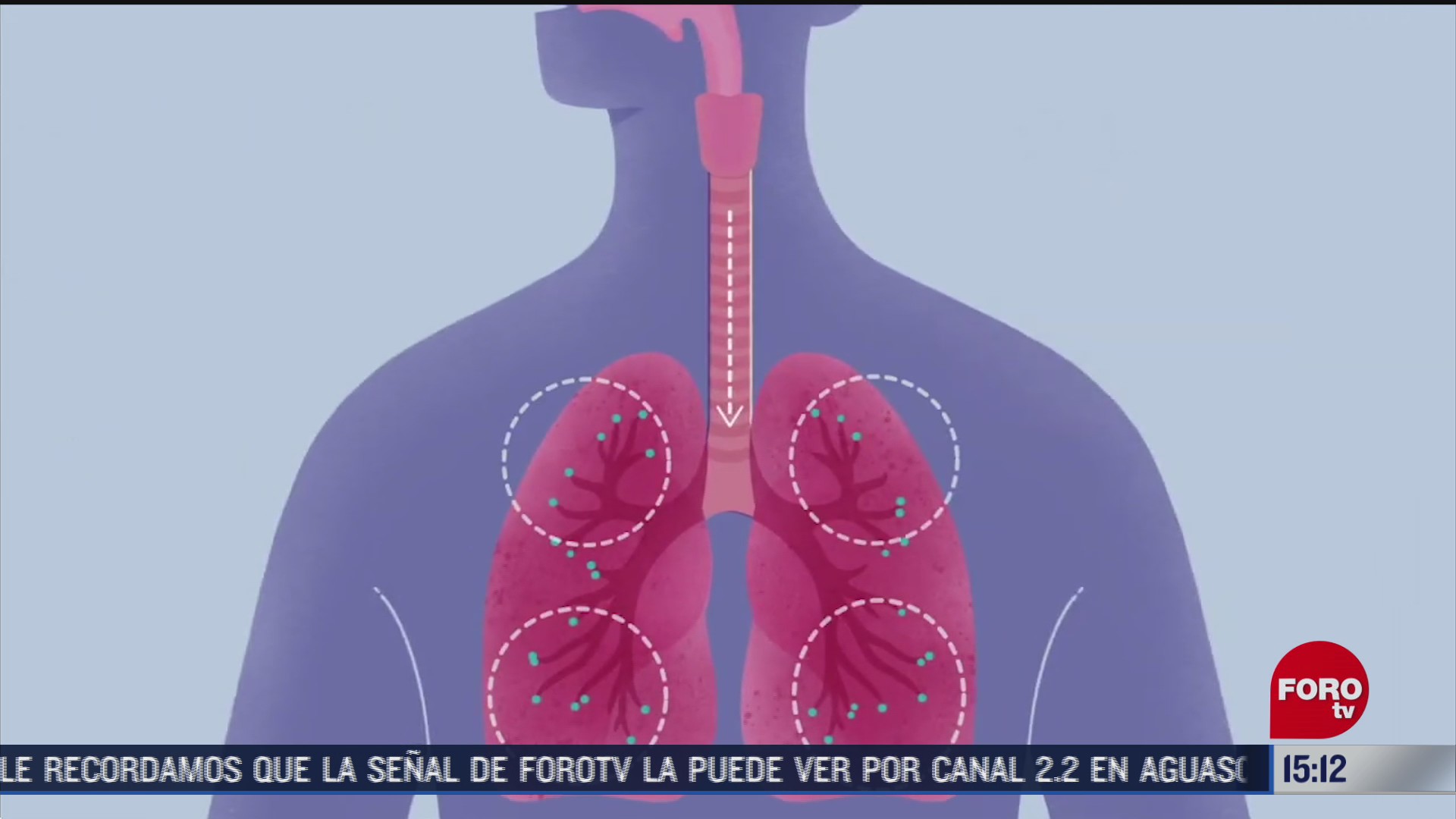 medicos recurren a diversas tecnicas para salvar los pulmones de enfermos covid