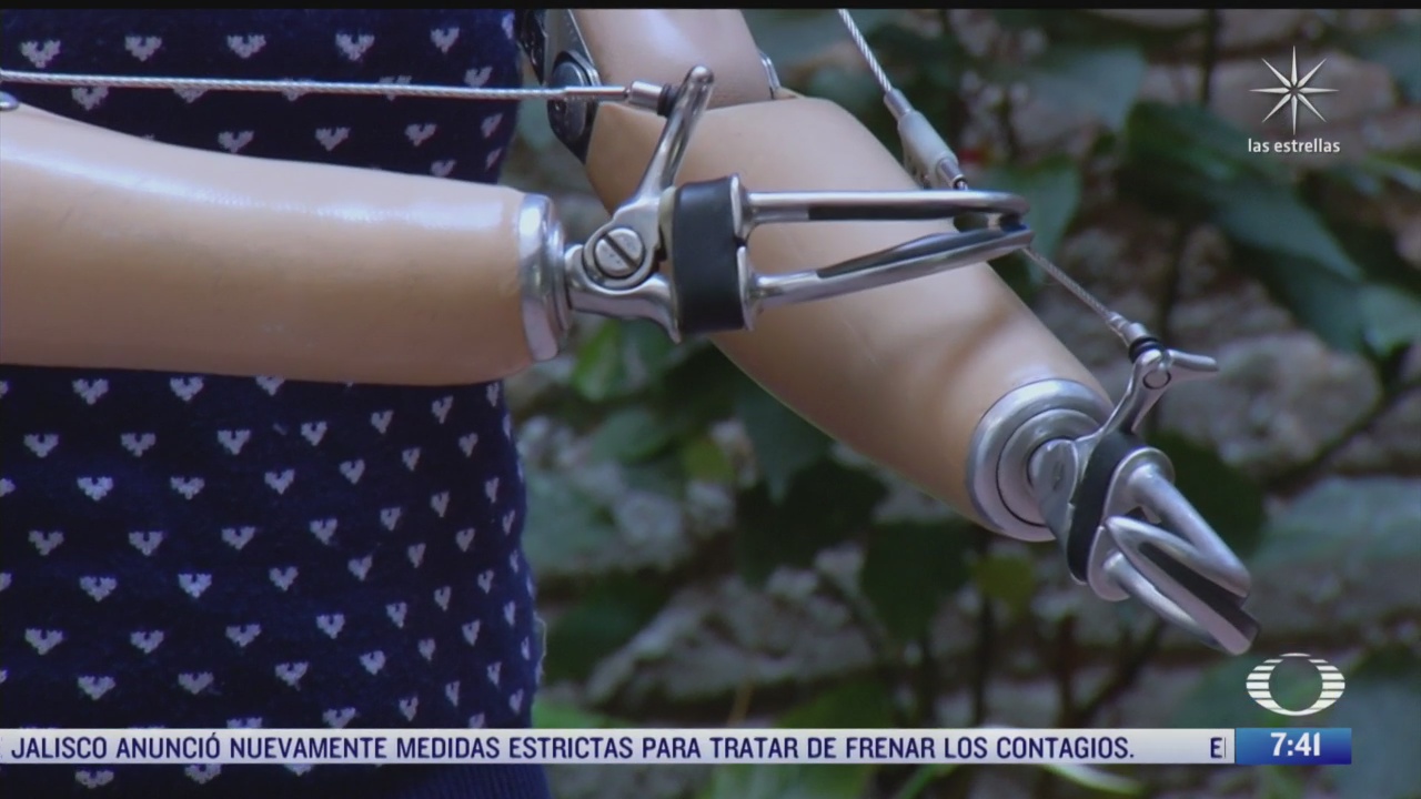 pocas personas con discapacidad en mexico consiguen protesis