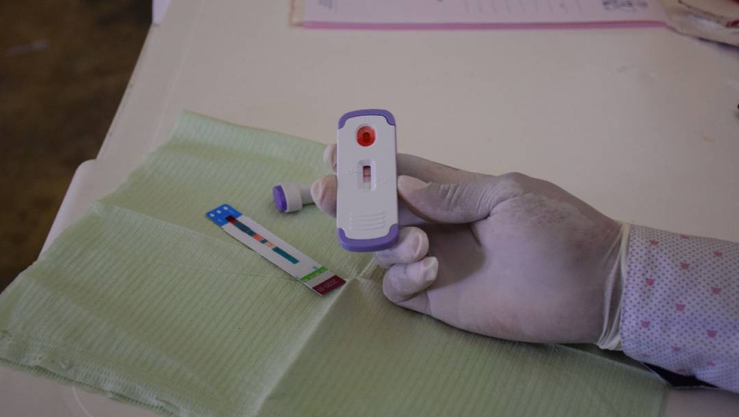 México participa en los ensayos fase 3 de una vacuna para prevenir el VIH