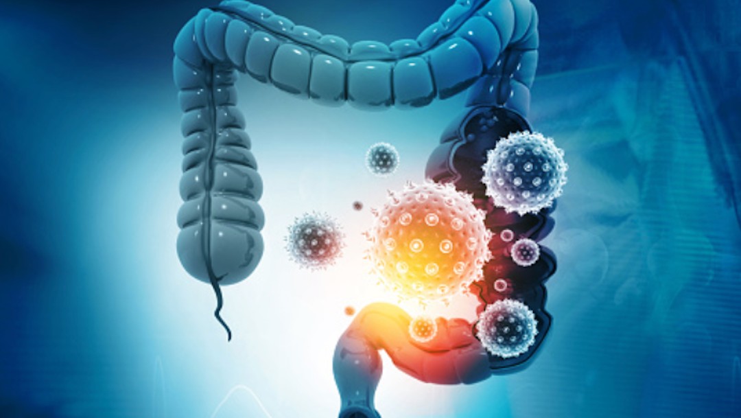 Virus en el estomago (pixabay)