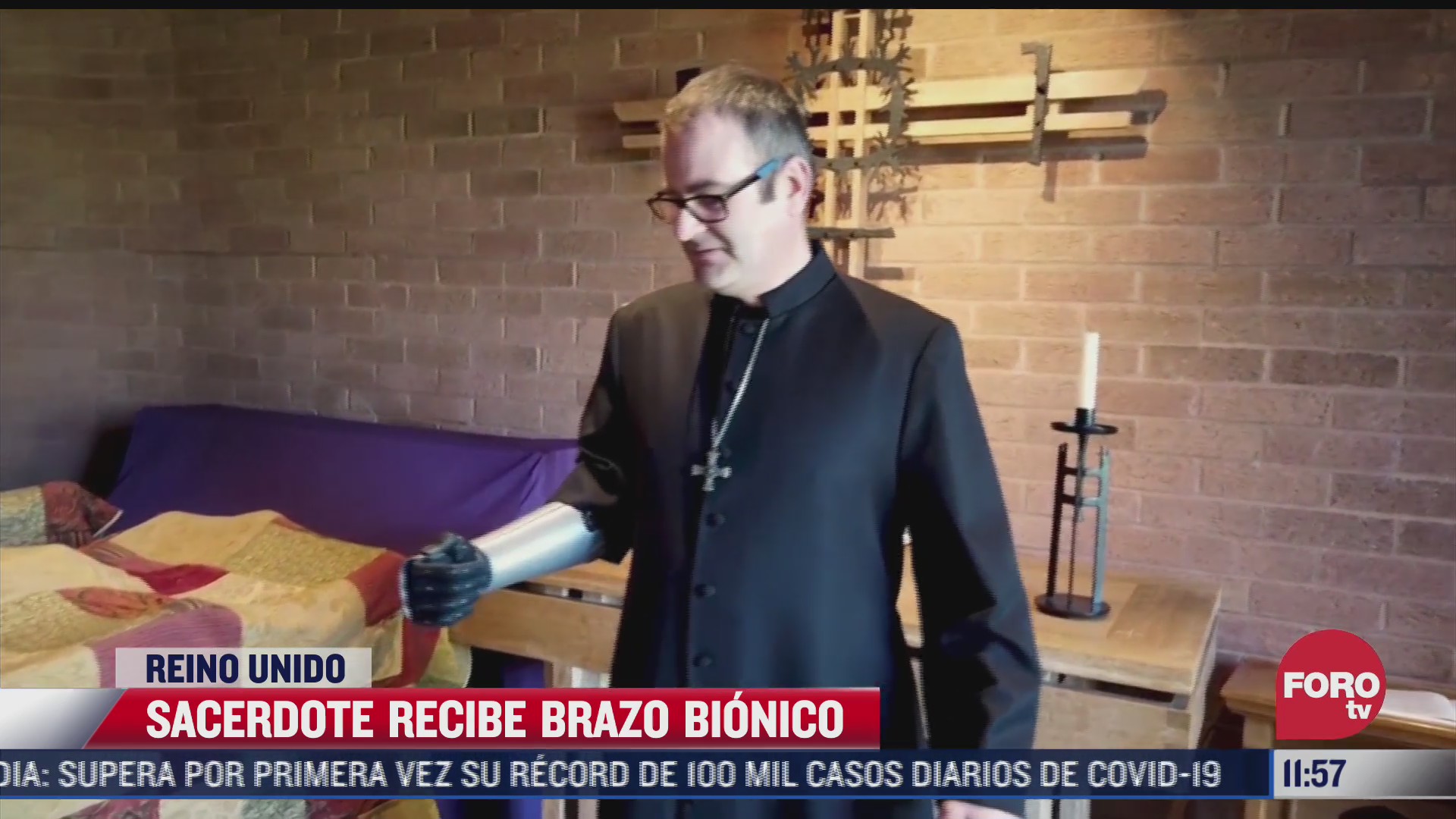 sacerdote recibe brazo bionico