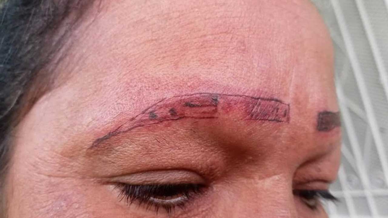 Mujer denuncia a tatuadores que arruinaron rostro a su madre