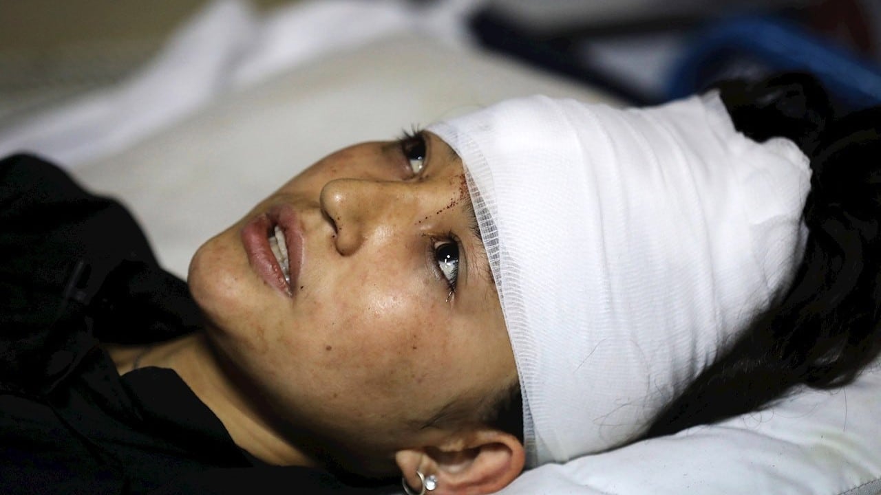 Una joven afgana sobreviviente al atentado en Kabul (EFE)