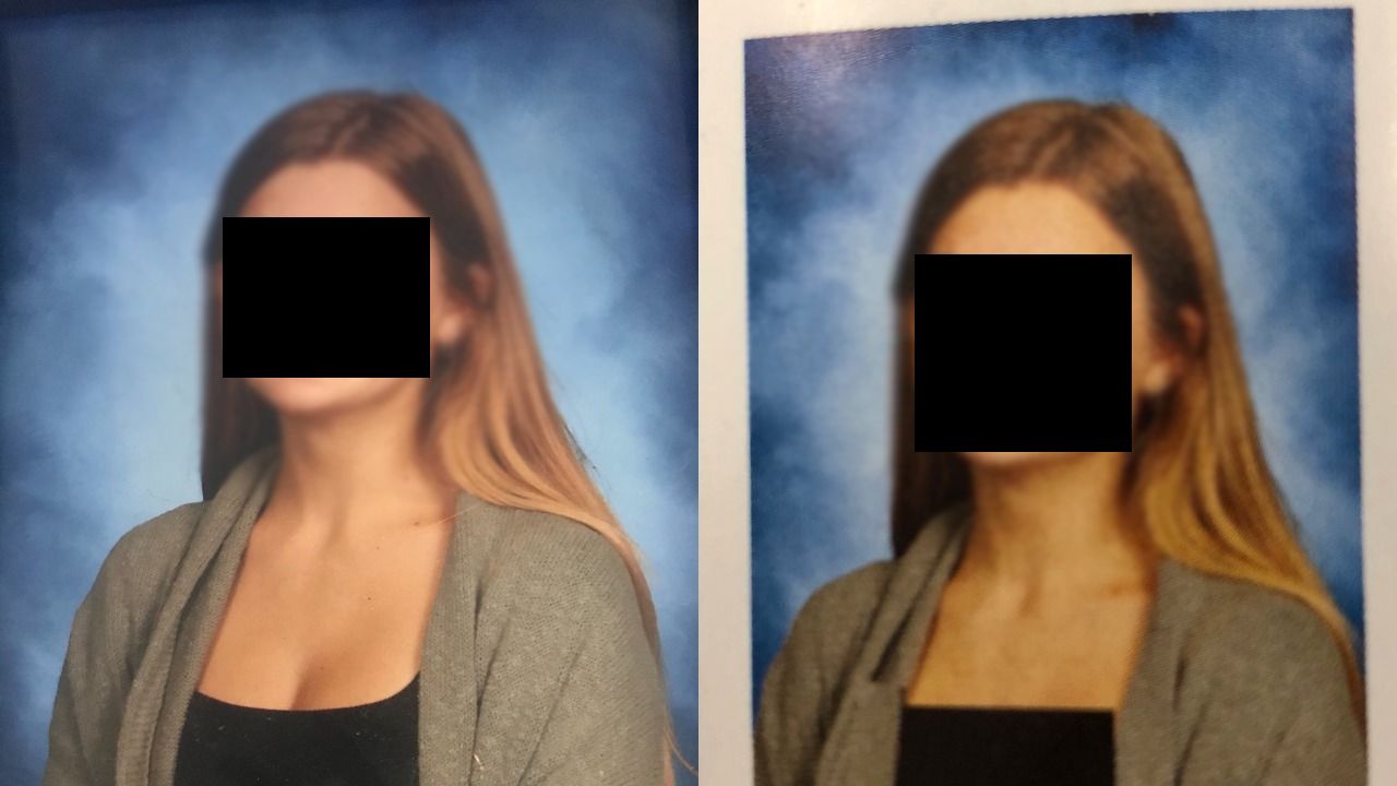 Escuela Alteró Fotos Escote Alumnas
