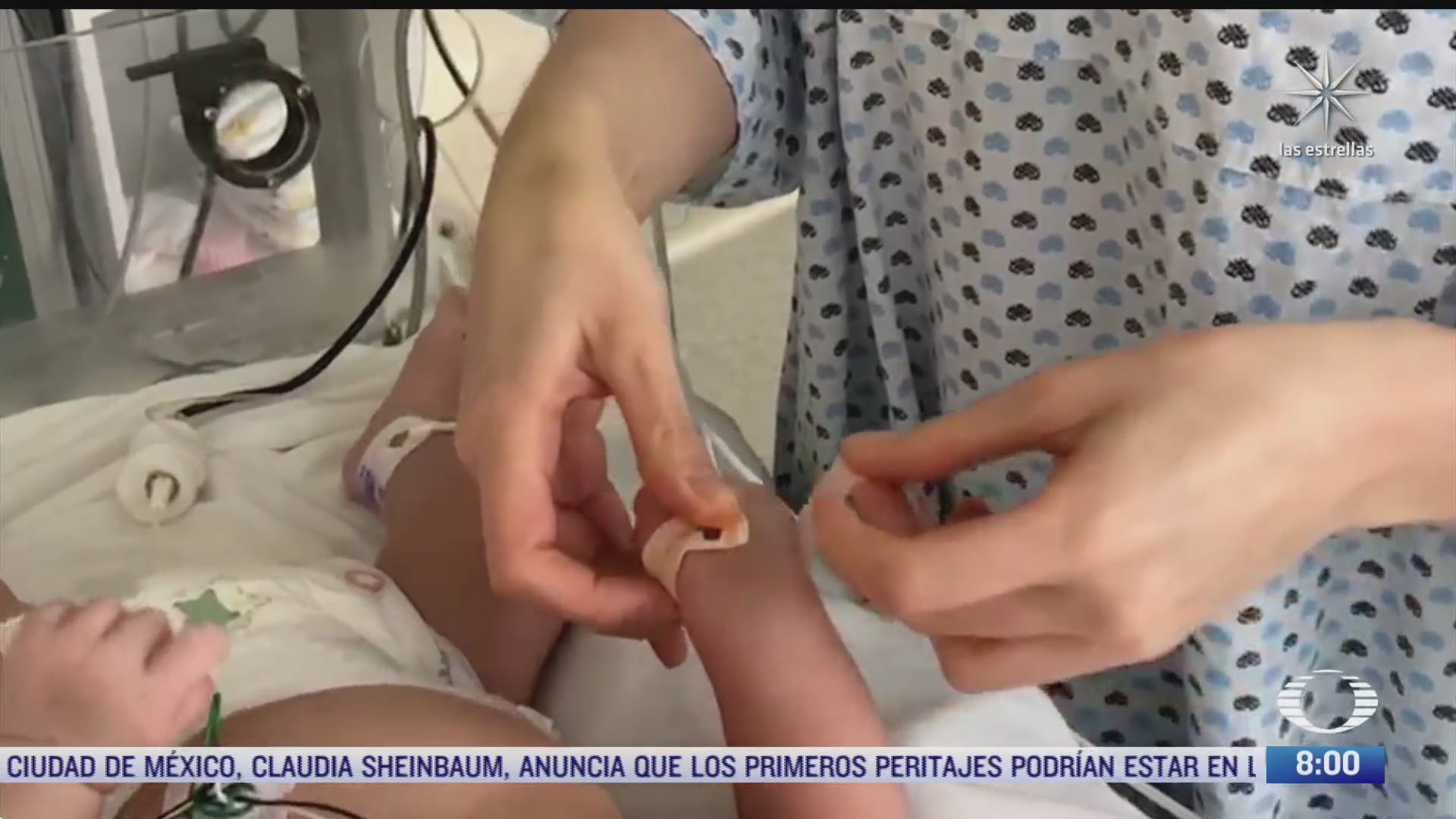 mexico realizara el tamiz cardiologico neonatal a todos los recien nacidos