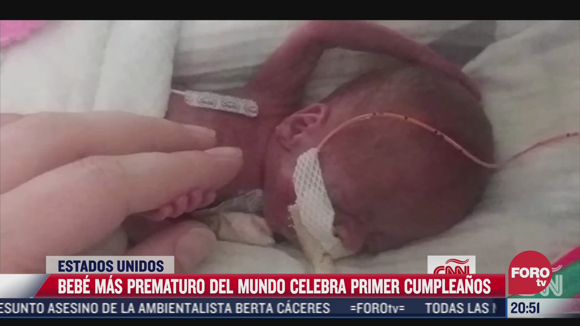 bebe mas prematuro del mundo celebra primer cumpleanos