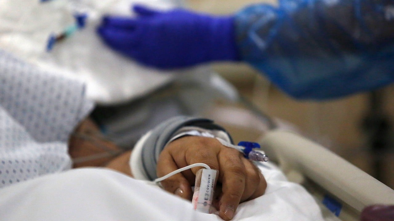 Un paciente internado en un hospital por COVID-19 en Chile (Getty Images)