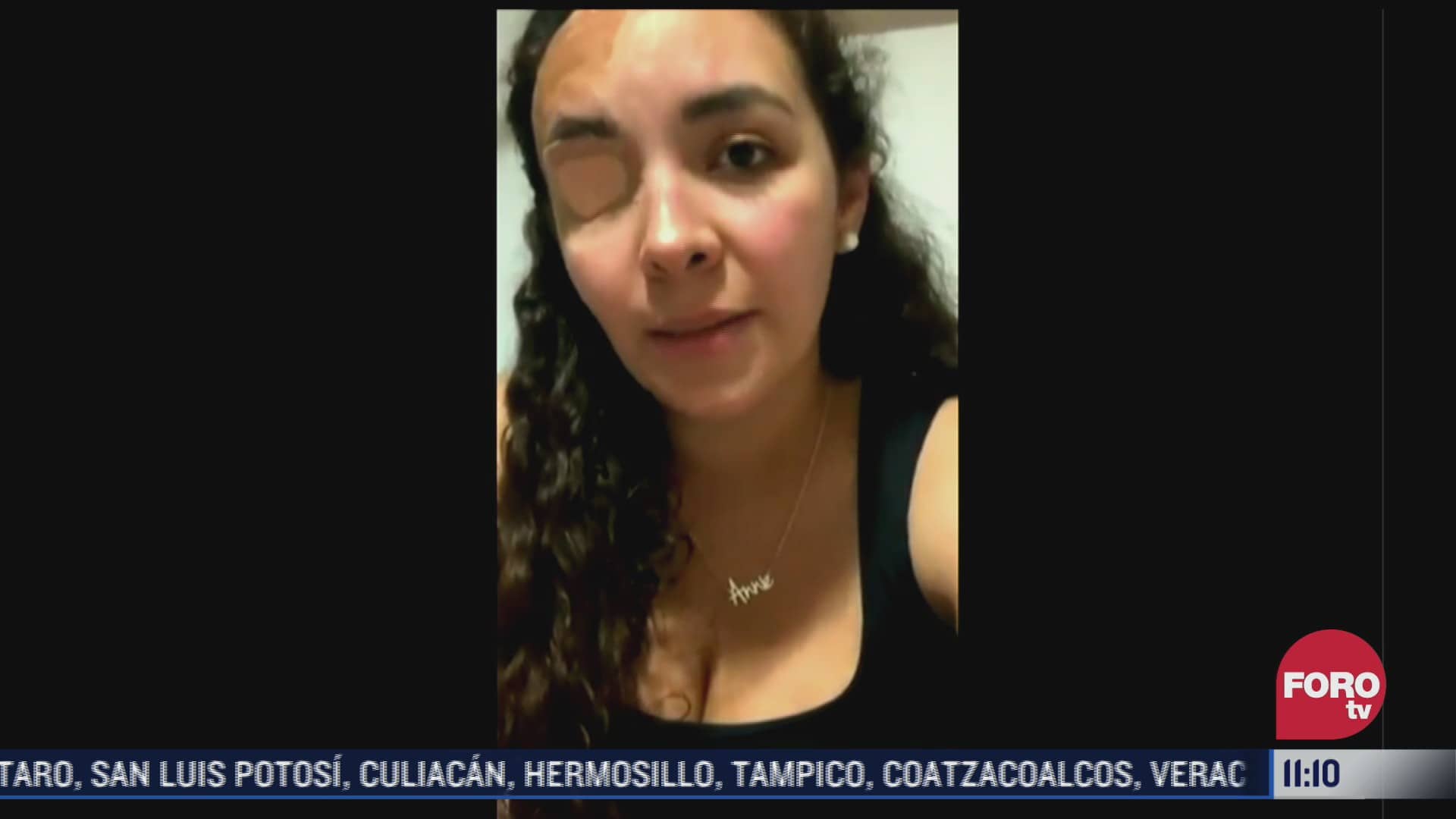 ana helena pide buscar a mujer que la ataco con acido en cdmx