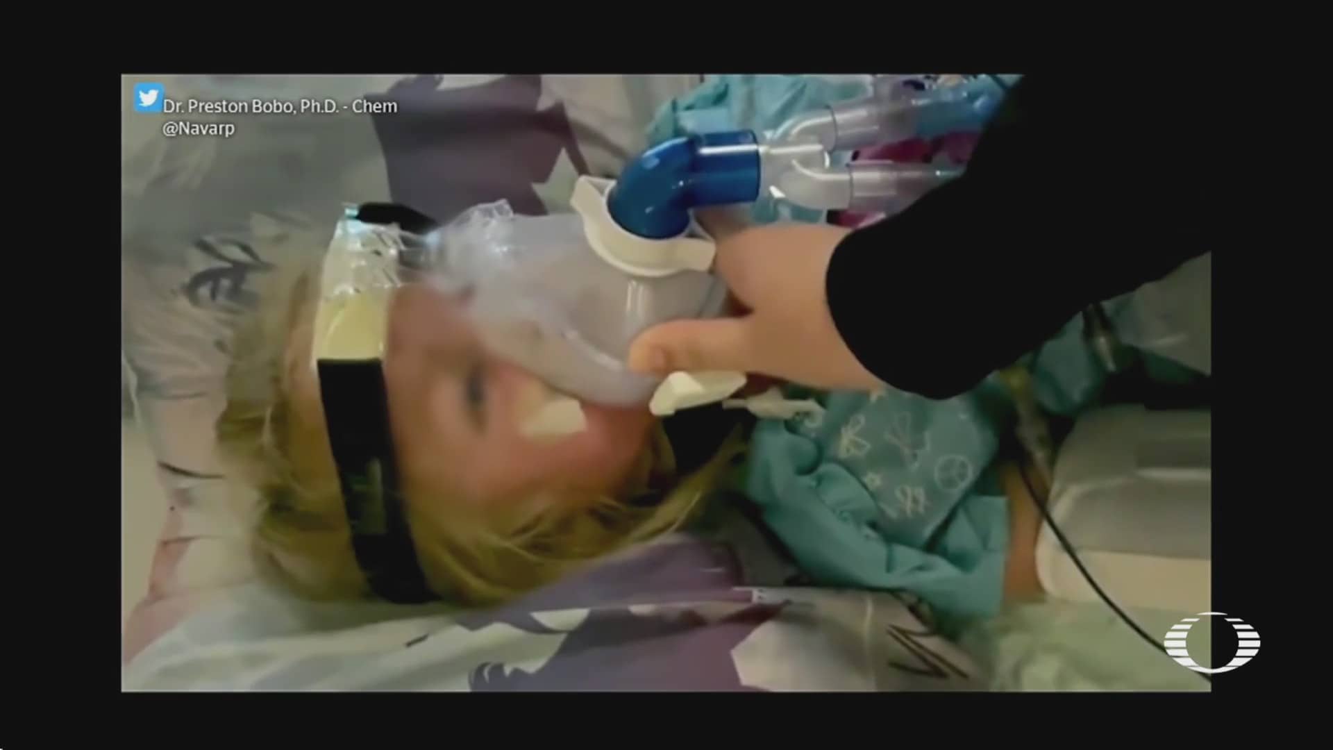 nina de 3 anos lucha contra el covid conectada a un respirador