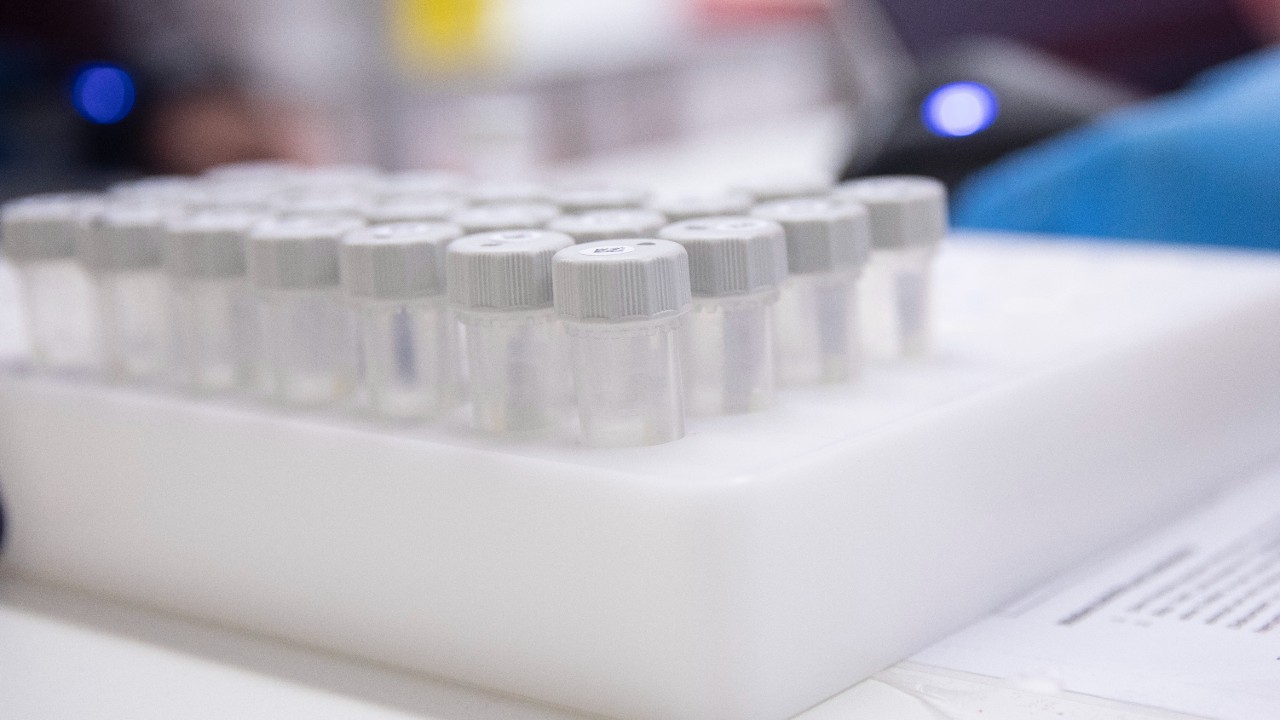 Realizan innovadora prueba PCR para detectar covid en niños como si fuera paleta
