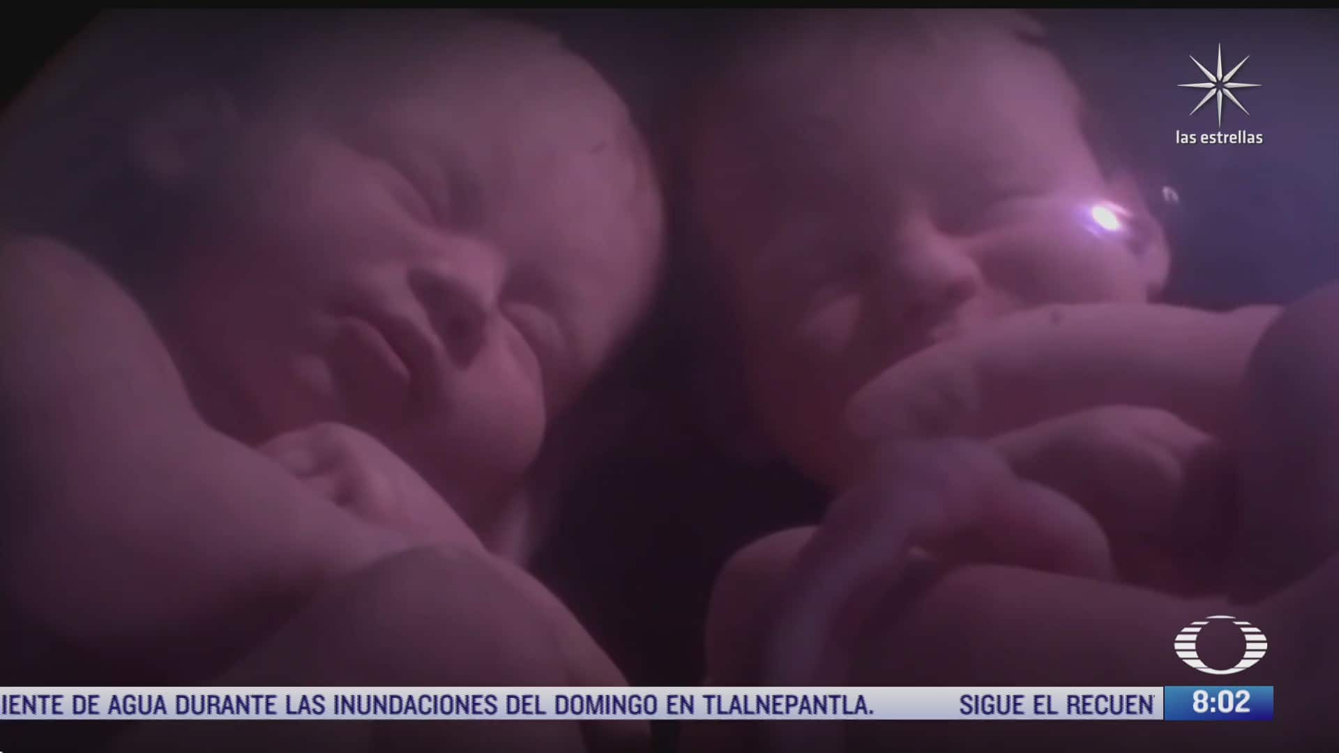 que es twins mx el primer registro de gemelos en mexico