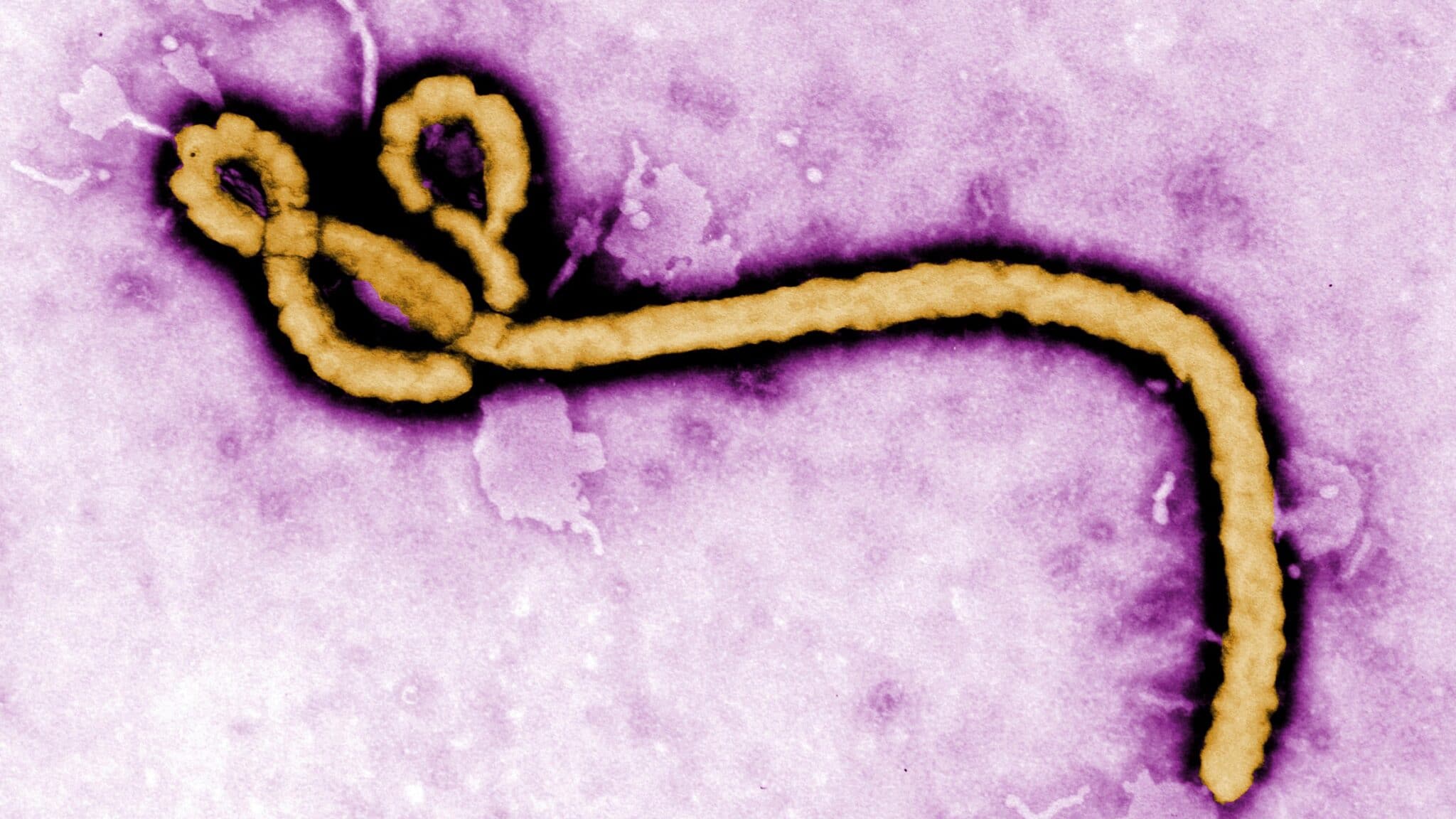 Casos de ébola en el Congo van en aumento; suman 5
