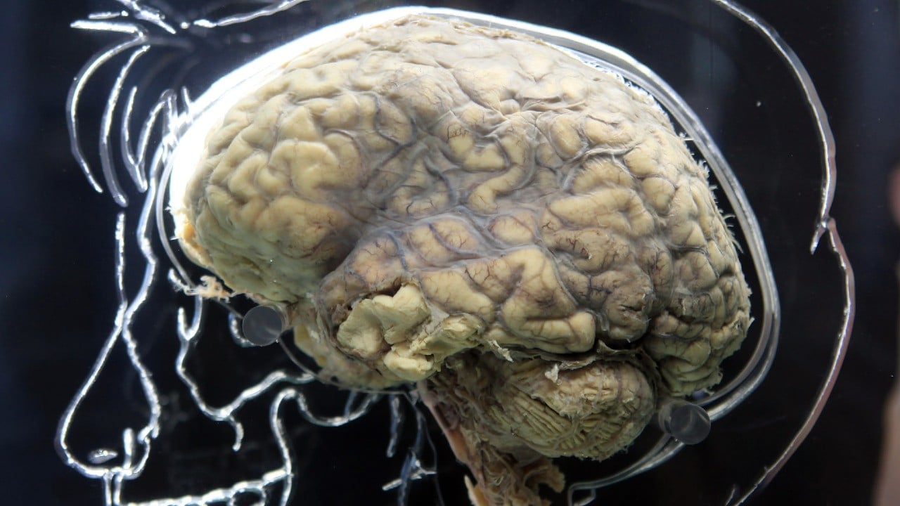 Hipocampo del cerebro tiene células madre que permiten que las neuronas se regeneren
