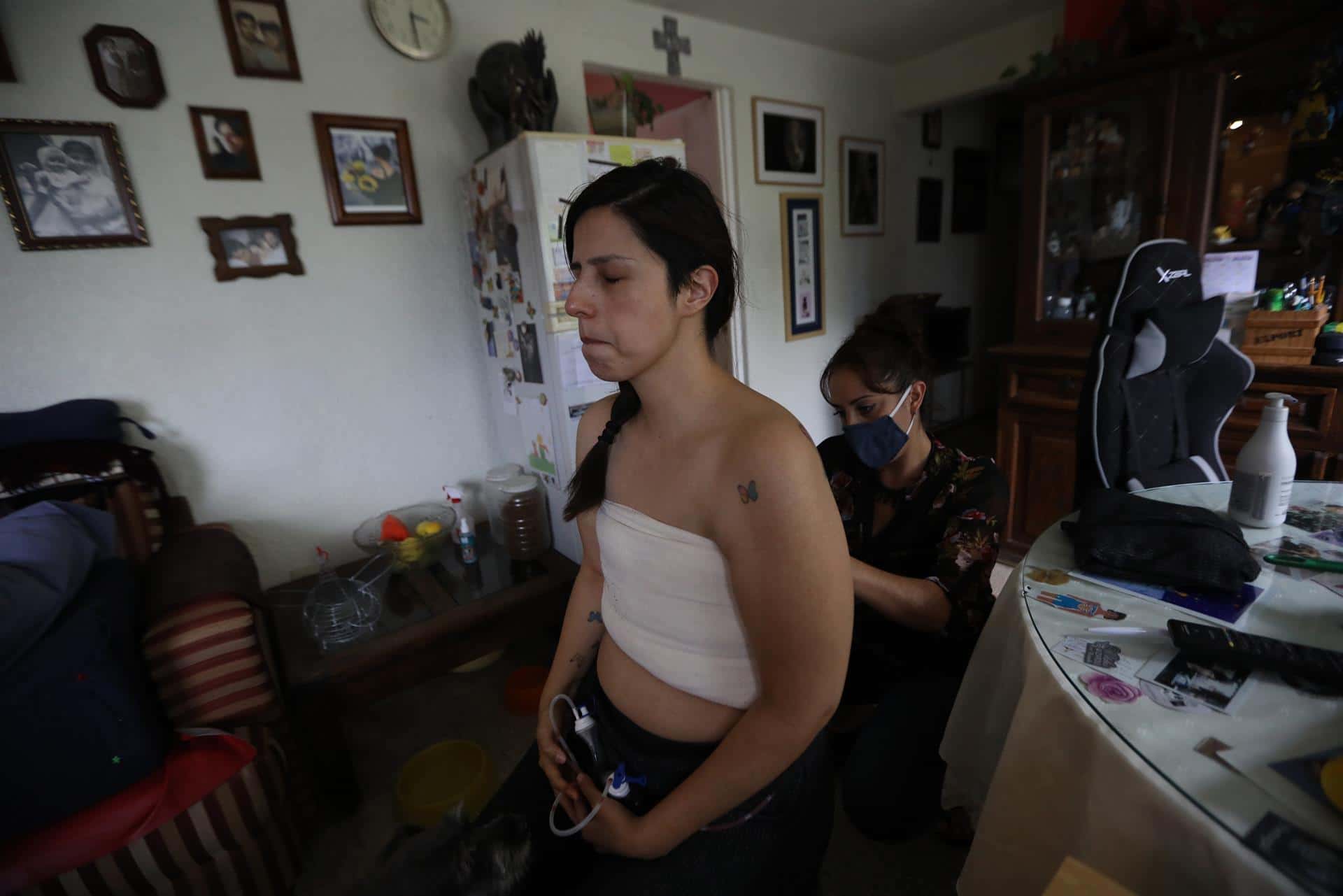 'Jódete cáncer', tras extirpación de senos, Sandra Monroy reivindica sus cicatrices en sesión fotográfica
