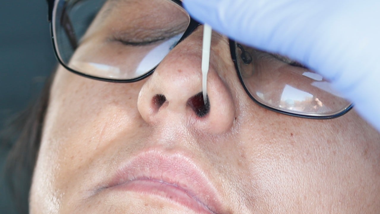 Covid afecta los ojos y deja secuelas hasta por 10 meses, según estudio