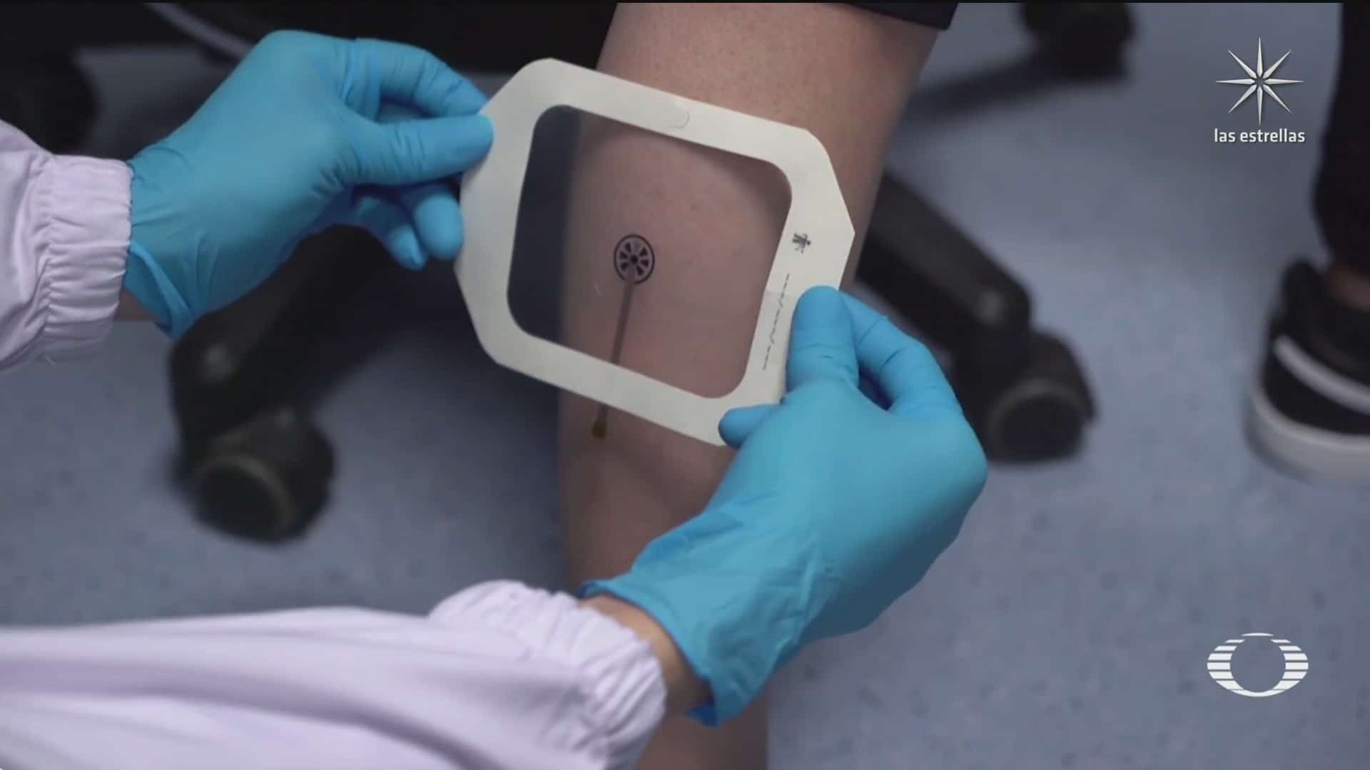 desarrollan en singapur vendaje inteligente para monitorear las heridas en la piel